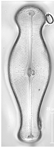 image of the diatom Didymo