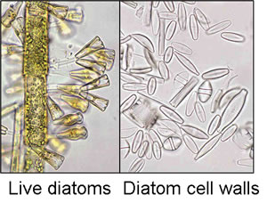 diatom photos